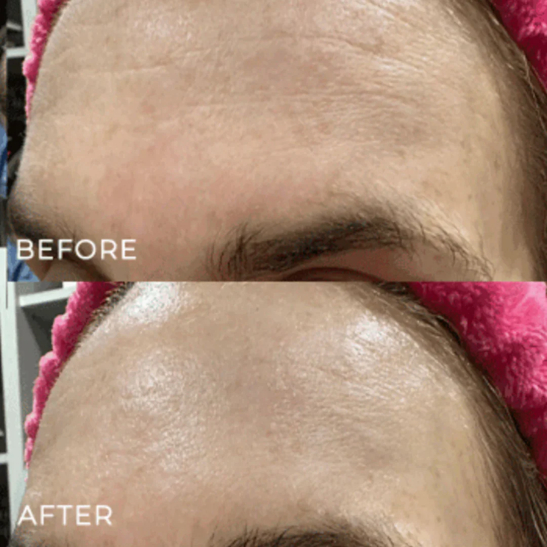 Ella & Jo The Miracle Mask - Hydrating And Plumping - Image 5