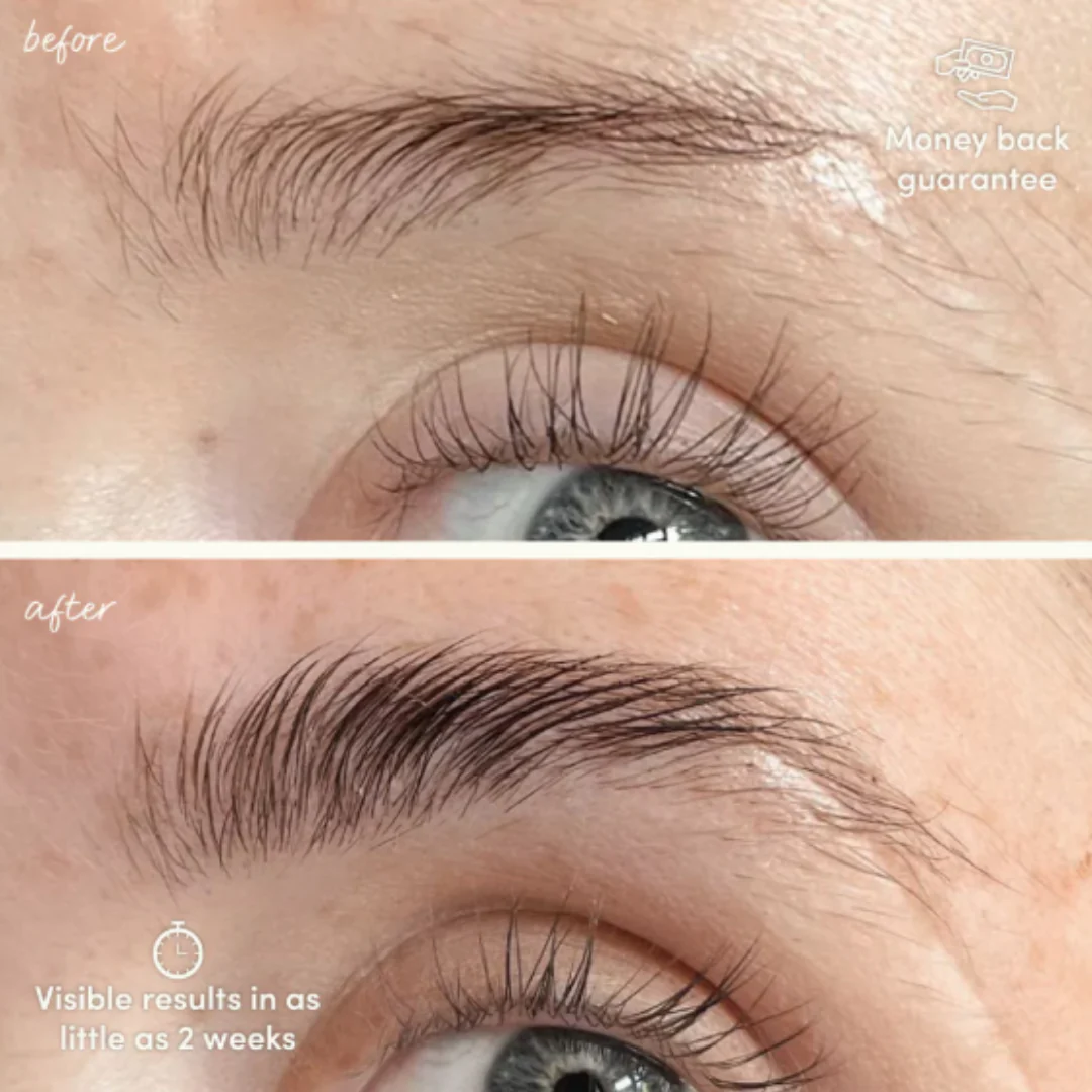 Glow For It Brow Growth Serum - Image 3
