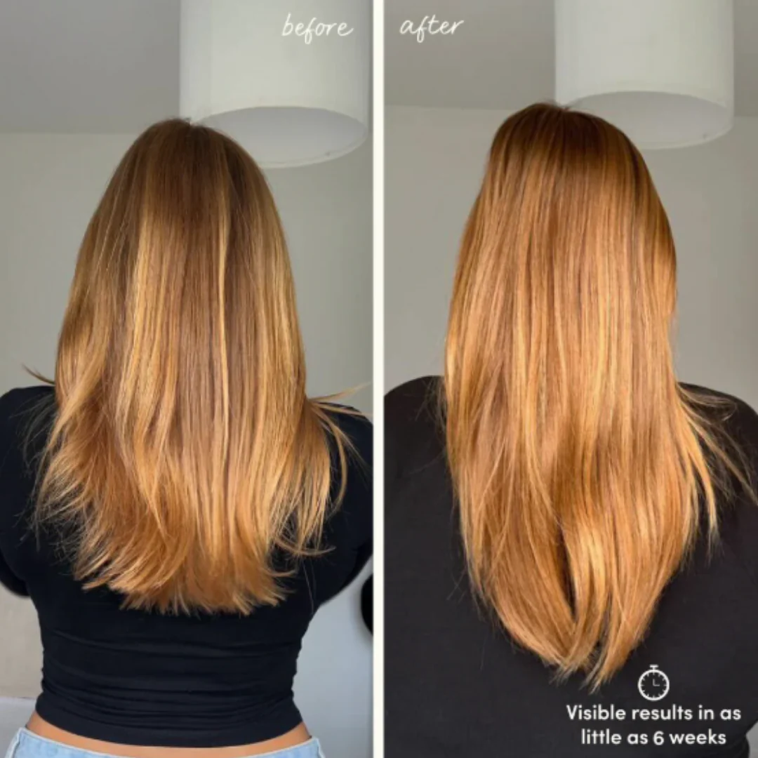 Glow For It Hair Growth Serum - Image 3