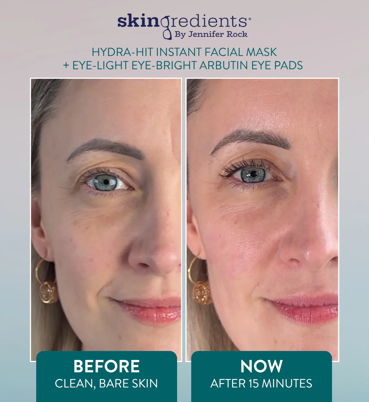 Skingredients Eye-Light Eye-Bright Under-Eye Pads – Hydrating Eye Pads for Dark Circles & Puffiness - Image 3