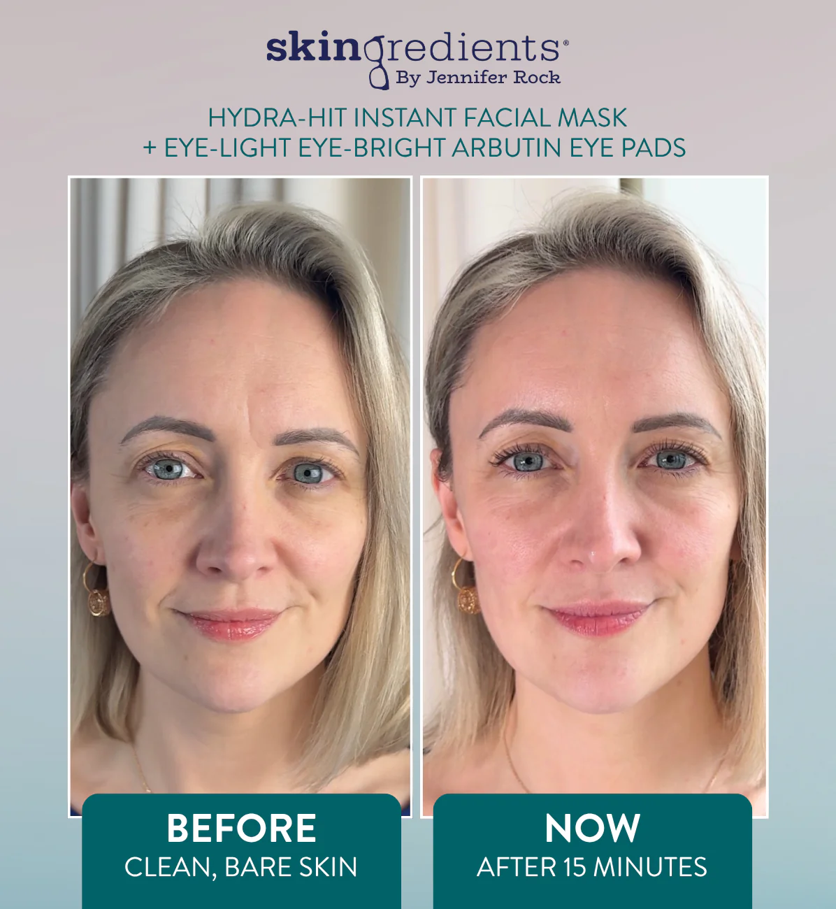 Skingredients Eye-Light Eye-Bright Under-Eye Pads – Hydrating Eye Pads for Dark Circles & Puffiness - Image 4