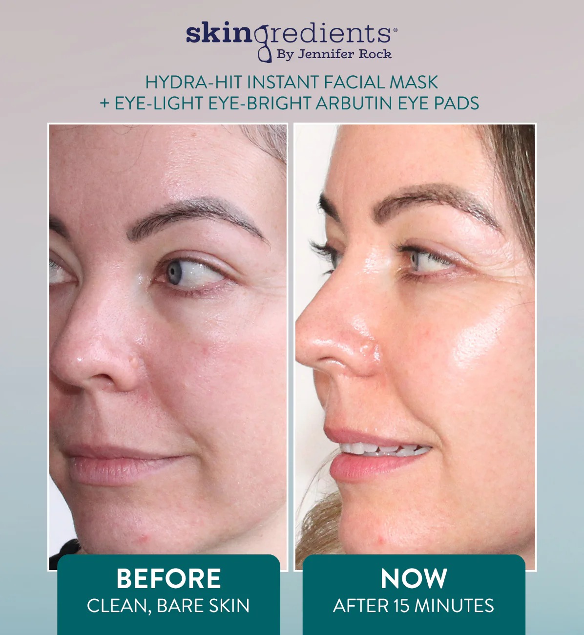 Skingredients Eye-Light Eye-Bright Under-Eye Pads – Hydrating Eye Pads for Dark Circles & Puffiness - Image 5