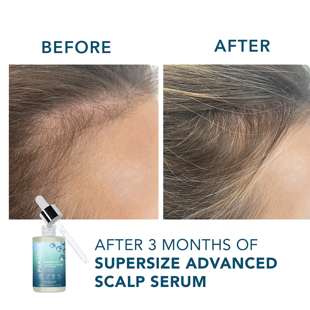 We Are Paradox Growth Advanced Scalp Serum 50ml - Image 3